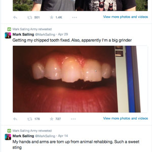 No “Glee” in Tooth Grinding